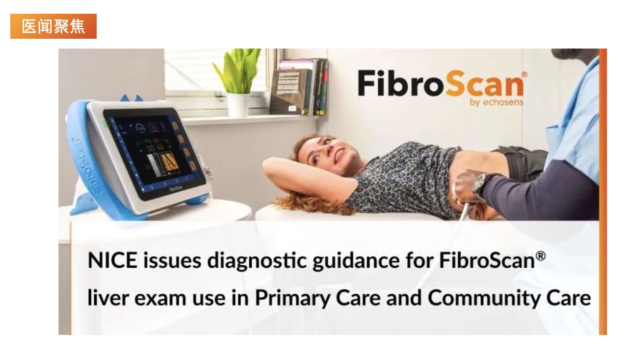 医闻聚焦 | NICE发布具有里程碑意义的指导意见，将常规肝脏扫描引入初级保健机构