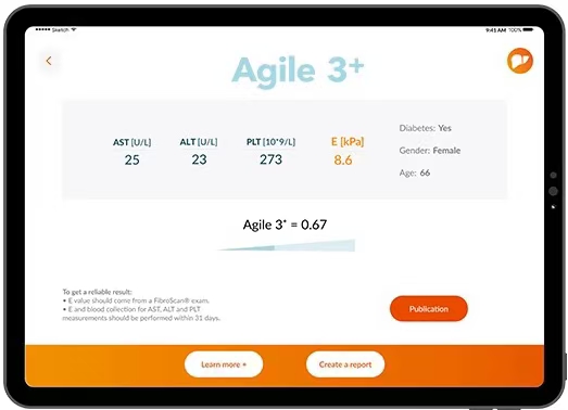 Agile 3+